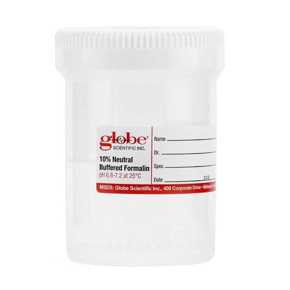 Formalin-filled jar