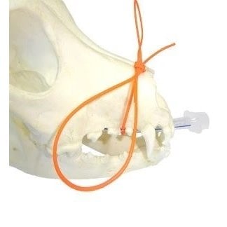 Anaesthesia tube ties