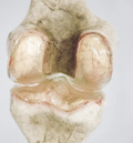 Cartilage Health