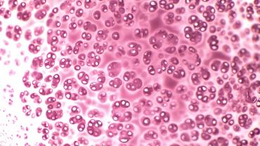 Chondroitin Sulfate